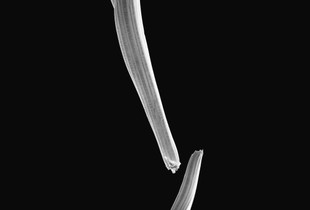 Osteoporosis -1-