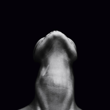 sternocleidomastoid