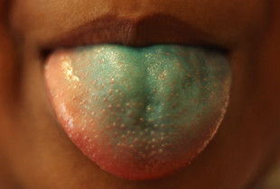 Lucky candy