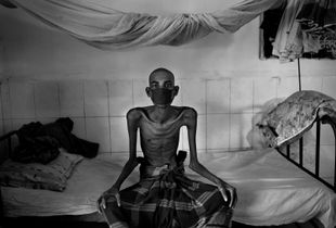 From the series "Tuberculosis in Bangladesh"