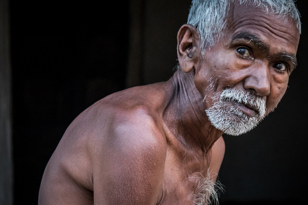 A Cruel Life in NE India: Ram Kumar, age 50.