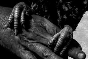 Hand and Feet