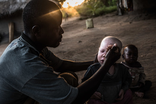 Mwanje washes his children Sekiringa and Marry in the morning, and applies sun screen with SPF protection 50+ to Sekiringa