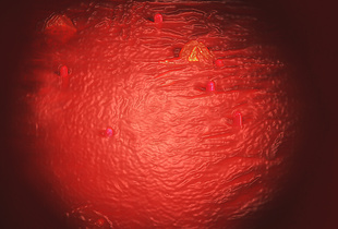 Endoscopy of Mars (Medical Mocks series).