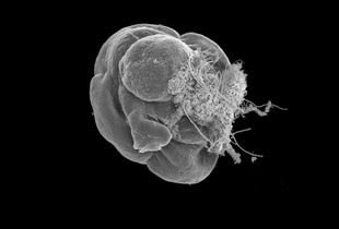 Aurelia Immortal (Polyp phase).