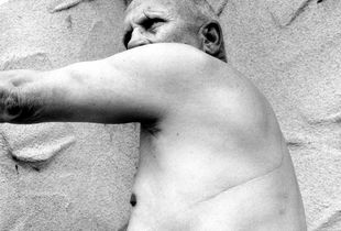 Reason  "Fred" Warehime, Atomic Veteran irradiated at the Nevada Test Site, shows the scar from the excision of his cancerous lung. Riverdale, California, 1988