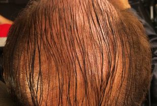 Comb_Over_The_Atlantic_2017
