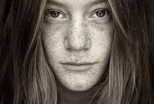 Freckles.Sera.