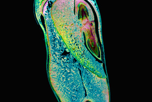 Corn Grain Zea (Modified Nature), 2008, 24” x 20”
