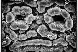 Canadian Yew Stomata