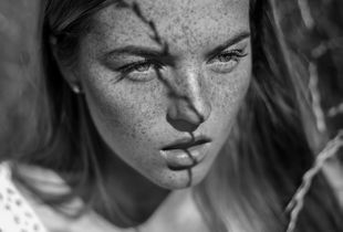 summer freckles