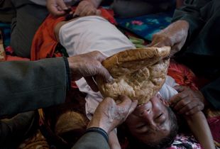 A 5 year old Gypsy boy being circumcised-a mandatory Muslim ritual. The procedure is performed by a medical doctor, called in for this occasion. Boys both grandfathers are holding his hands, while a piece of bread is placed in boy’s mouth, to prevent him from biting his tongue from pain.