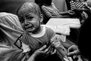 CANCER - CHILDHOOD