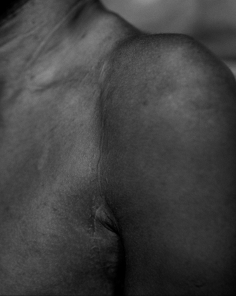 A different course mapped out in scars