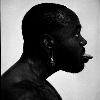 White tongue.