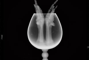 X-Bone-Ray