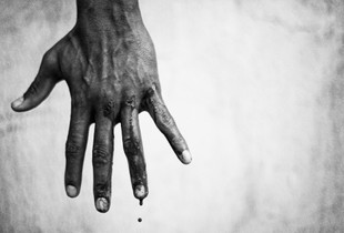 Korahn's bleeding hand