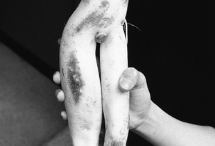 Two legged daikon