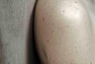 Untitled I (Skin Studies series)