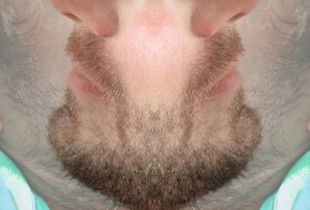 Jonatan