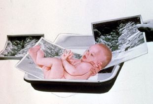 Reproduction, from Journal of a Miscarriage, 1973 ©Joanne Leonard.  Collection of Jeremy Stone, San Francisco