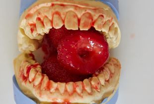 teeth and strawberries