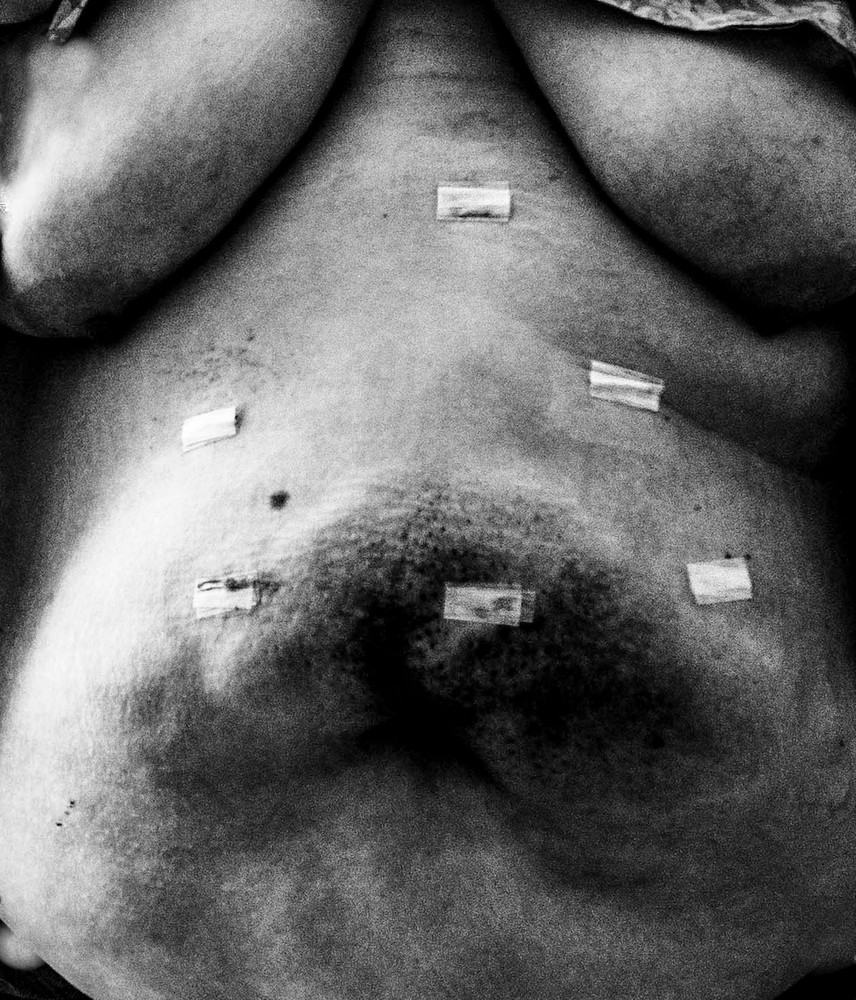 Self-Untitled