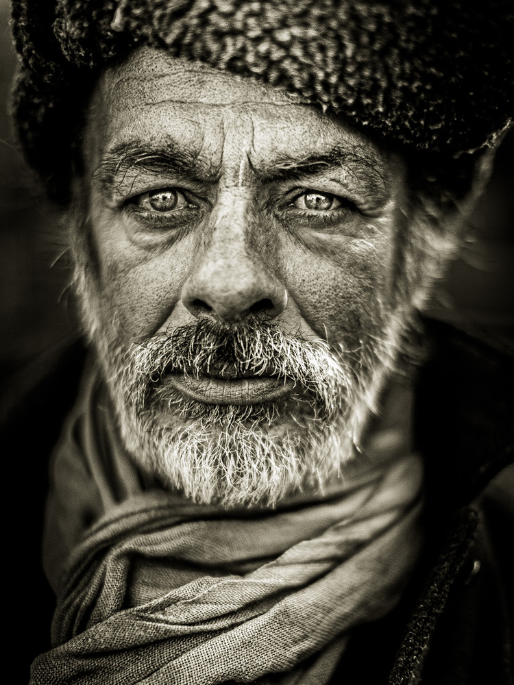 eye -and- contact.