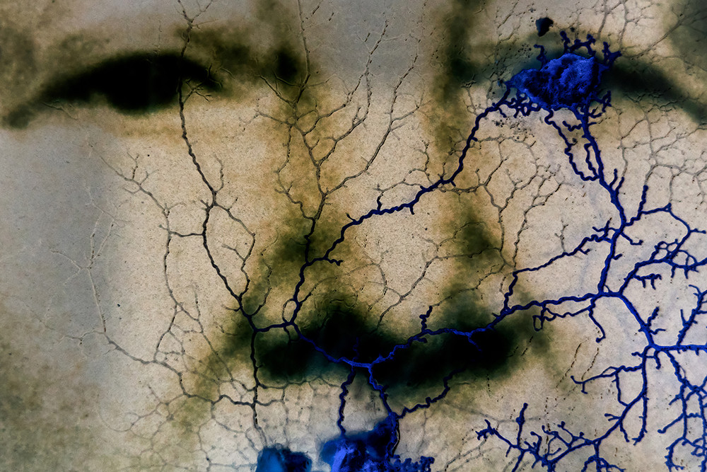 Genetic Memory