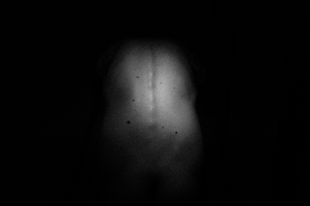 MMXVI