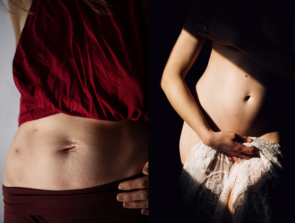 The Body Project