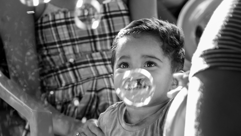 Operation Smile