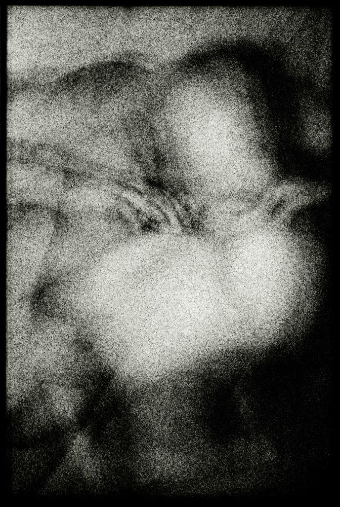 Delusions