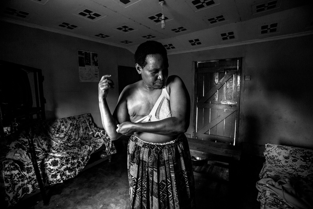Cancer in Africa
