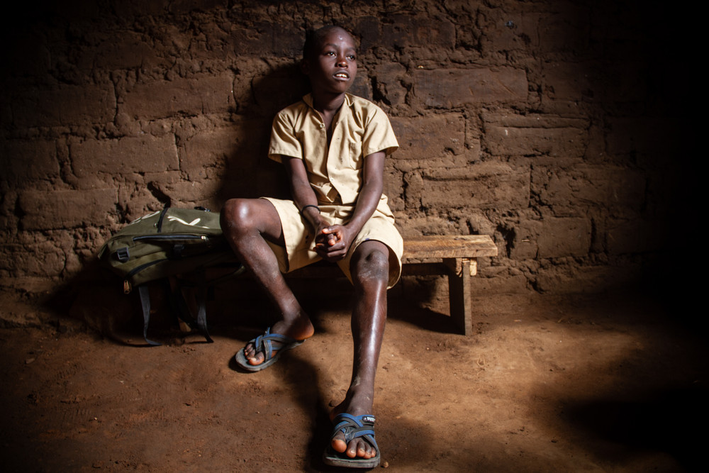 The 'voiceless' also exist 