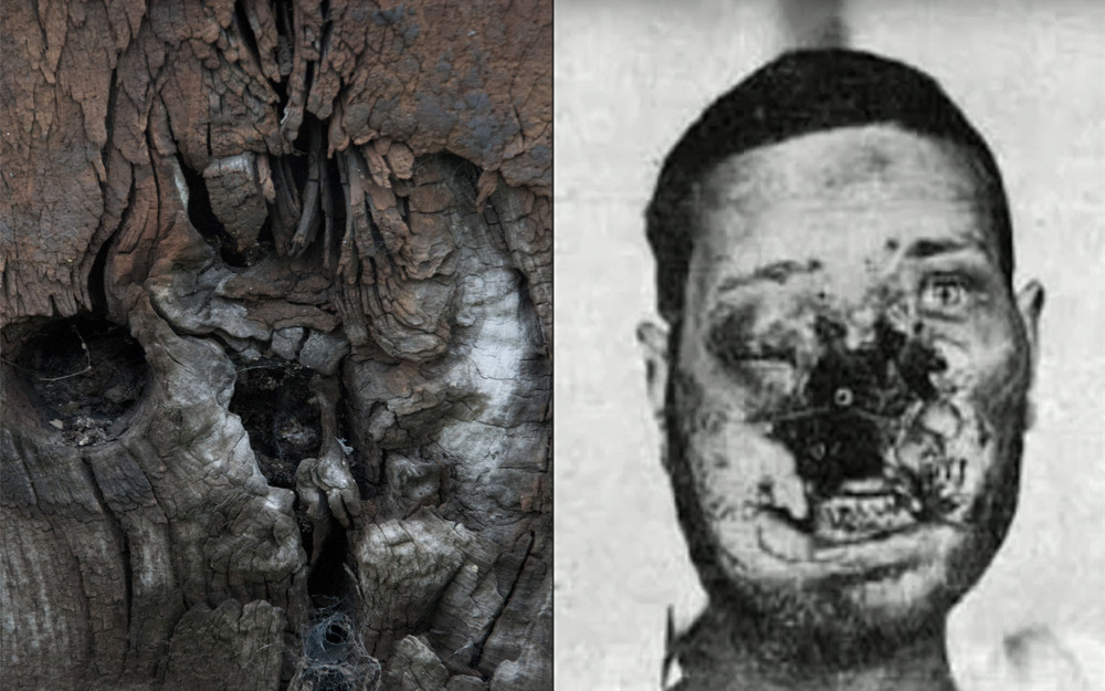 gueules cassées   broken faces