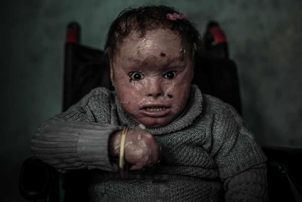 Faces of War