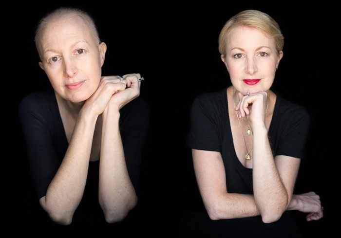 Facing Chemo