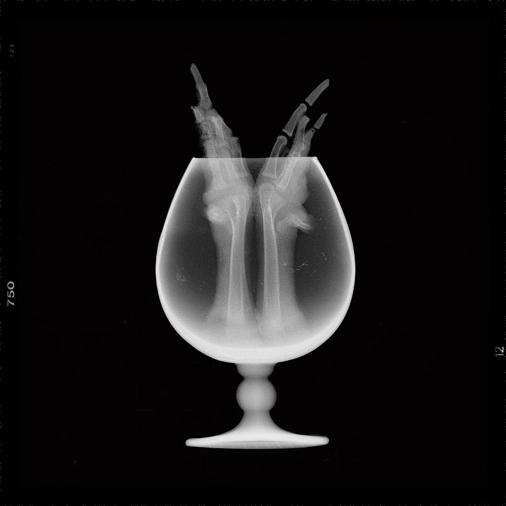 X-Bone-Ray