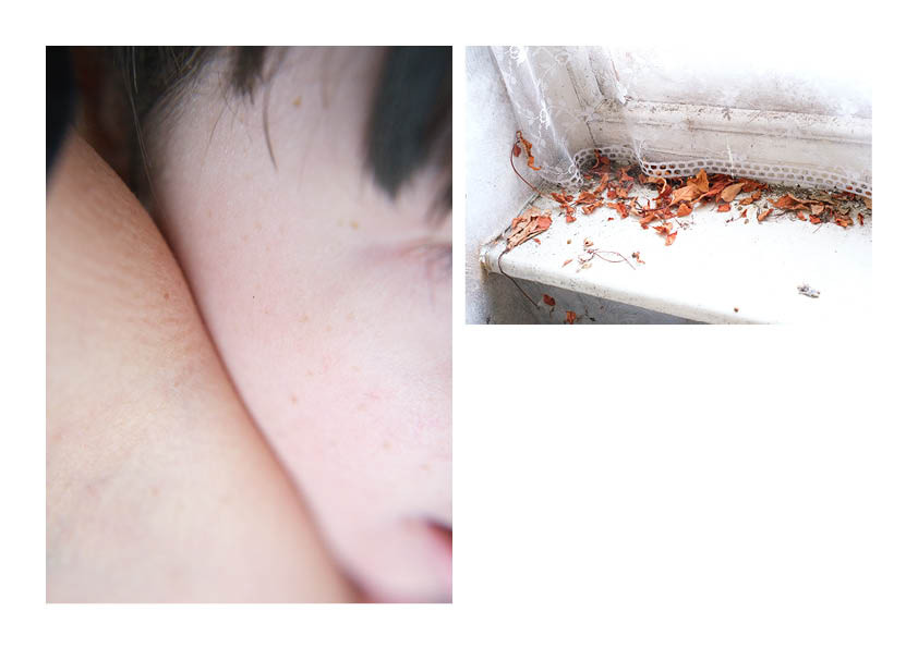 Skin to skin