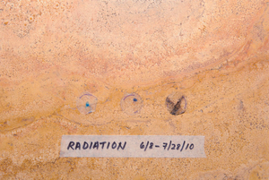 Radiation