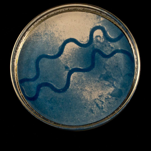 Syphilis One