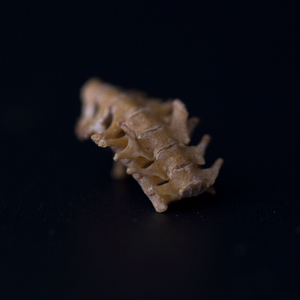 Spine