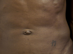 Umbilicus et Compunctum