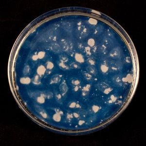 Chlamydia Four