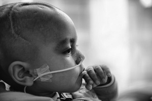 CANCER - CHILDHOOD