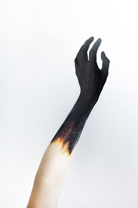 Sunburned, 2015