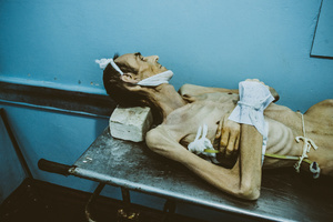 Gena, 1969. Diagnosis: MDR TB + HIV.  Kherson, July 2011.