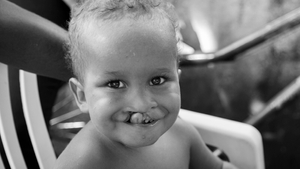 Operation Smile