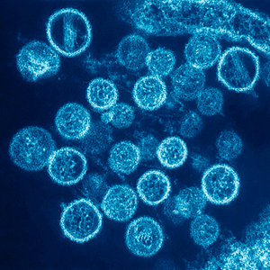Hantavirus